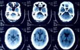a selection of X-ray scans of a human head